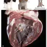 Endocardioza valvei mitrale
