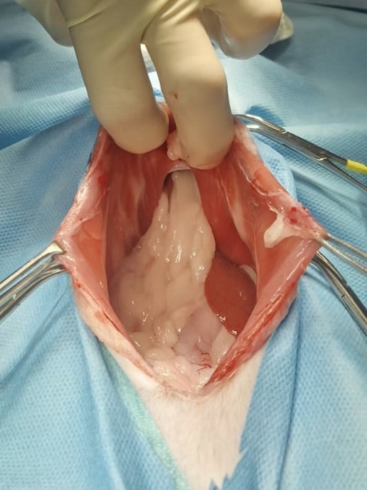peritoneoperikardiale diaphragmatische Hernie